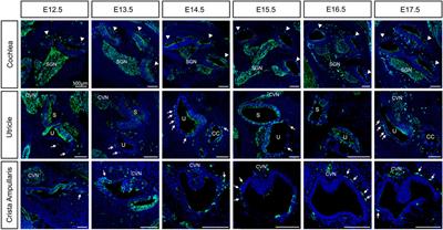 Intermediate Cells of Dual Embryonic Origin Follow a Basal to Apical Gradient of Ingression Into the Lateral Wall of the Cochlea